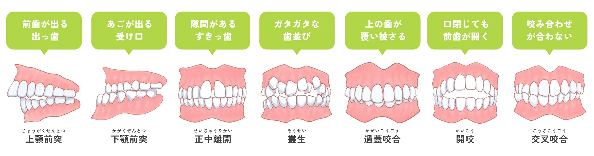 歯並び