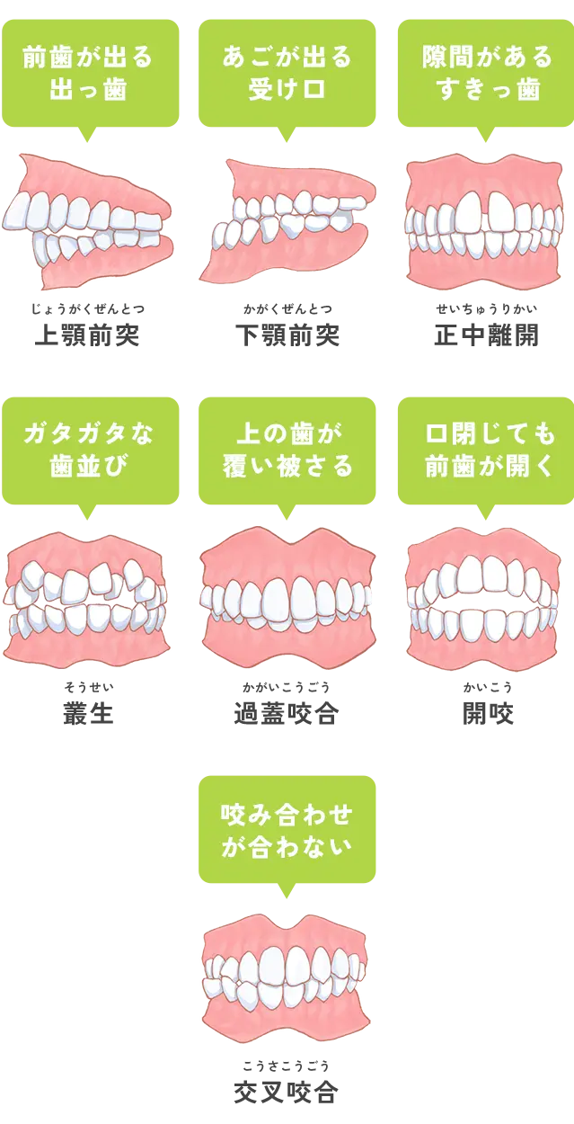 歯並び