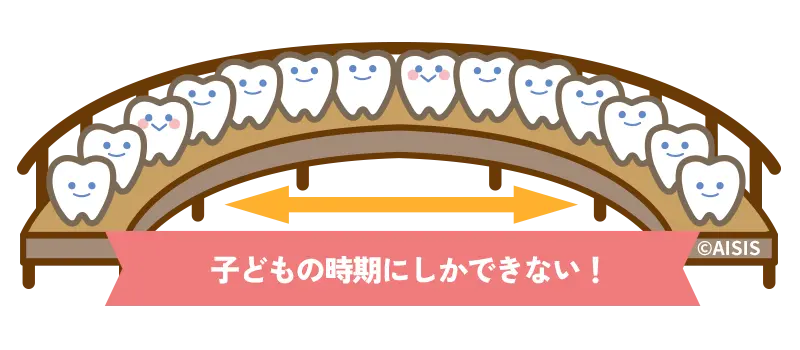 あごを広げる矯正
