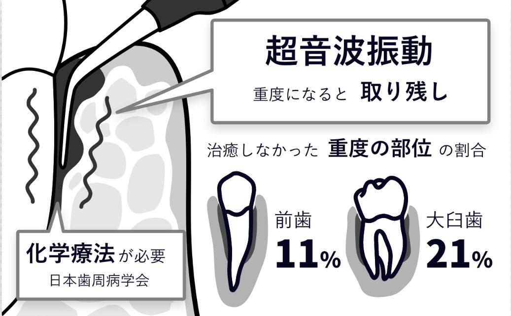 ラジカル殺菌技術説明