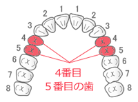 CAD/CAM冠