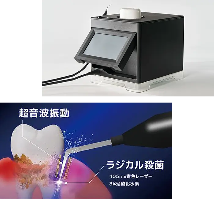 ブルーラジカル