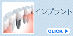インプラント